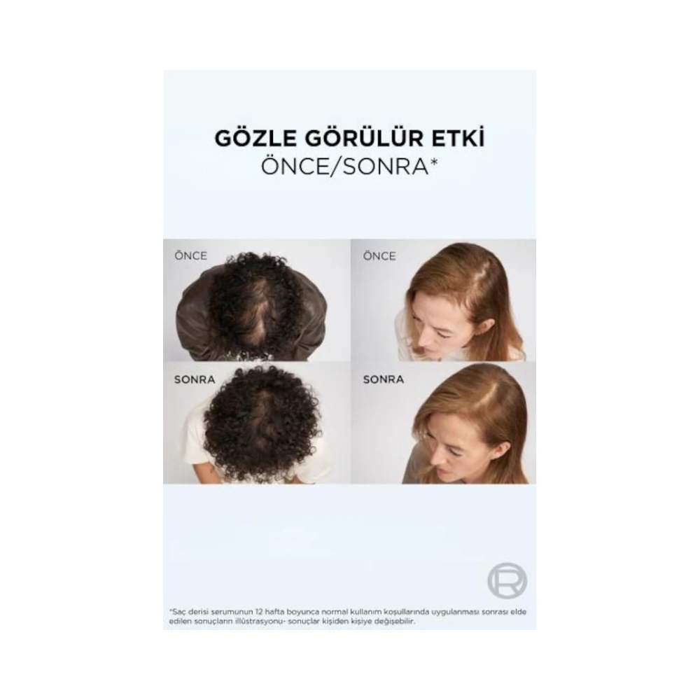 Elseve Growth Booster Dökülme Karşıtı Şampuan 200ml